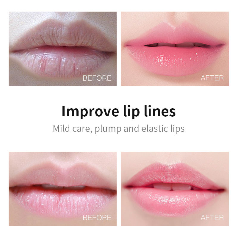 💄 Masque Lèvres Hydrogel Collagène – Effet Hydratant &amp; Repulpant